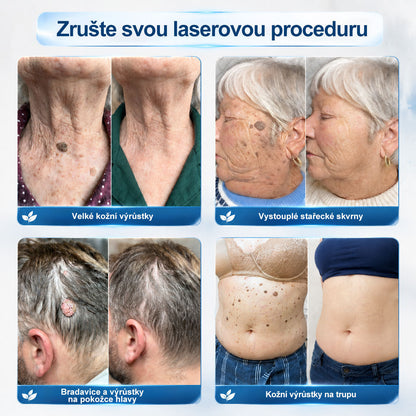 Hiskin®🎁 Zbývá už jen 5 balení!🔥 Nyní získáte další slevu 50 %!✨ Dopřejte si péči, kterou si zasloužíte, a udělejte něco pro svůj lepší pocit každý den.⏳ Nečekejte příliš dlouho — tato speciální nabídka nemusí být znovu dostupná.