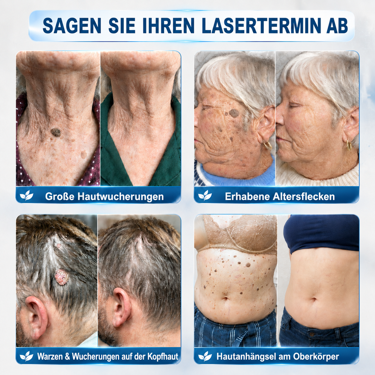 🇩🇪 𝐇𝐈𝐒𝐊𝐈𝐍®👩‍⚕️ 𝟕-𝐓𝐚𝐠𝐞-𝐇𝐚𝐮𝐭𝐚𝐧𝐡ä𝐧𝐠𝐬𝐞𝐥- & 𝐅𝐥𝐞𝐜𝐤𝐞𝐧𝐞𝐧𝐭𝐟𝐞𝐫𝐧𝐞𝐫 – 𝐅𝐨𝐫𝐭𝐬𝐜𝐡𝐫𝐢𝐭𝐭𝐥𝐢𝐜𝐡𝐞𝐫 𝐑𝐨𝐥𝐥-𝐨𝐧-𝐒𝐭𝐢𝐟𝐭 𝐳𝐮𝐫 𝐬𝐜𝐡𝐦𝐞𝐫𝐳𝐟𝐫𝐞𝐢𝐞𝐧 𝐮𝐧𝐝 𝐧𝐚𝐫𝐛𝐞𝐧𝐟𝐫𝐞𝐢𝐞𝐧 𝐄𝐧𝐭𝐟𝐞𝐫𝐧𝐮𝐧𝐠 𝐯𝐨𝐧 𝐇𝐚𝐮𝐭𝐮𝐧𝐫𝐞𝐢𝐧𝐡𝐞𝐢𝐭𝐞𝐧