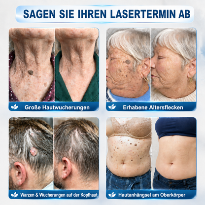 🇩🇪 𝐇𝐈𝐒𝐊𝐈𝐍®👩‍⚕️ 𝟕-𝐓𝐚𝐠𝐞-𝐇𝐚𝐮𝐭𝐚𝐧𝐡ä𝐧𝐠𝐬𝐞𝐥- & 𝐅𝐥𝐞𝐜𝐤𝐞𝐧𝐞𝐧𝐭𝐟𝐞𝐫𝐧𝐞𝐫 – 𝐅𝐨𝐫𝐭𝐬𝐜𝐡𝐫𝐢𝐭𝐭𝐥𝐢𝐜𝐡𝐞𝐫 𝐑𝐨𝐥𝐥-𝐨𝐧-𝐒𝐭𝐢𝐟𝐭 𝐳𝐮𝐫 𝐬𝐜𝐡𝐦𝐞𝐫𝐳𝐟𝐫𝐞𝐢𝐞𝐧 𝐮𝐧𝐝 𝐧𝐚𝐫𝐛𝐞𝐧𝐟𝐫𝐞𝐢𝐞𝐧 𝐄𝐧𝐭𝐟𝐞𝐫𝐧𝐮𝐧𝐠 𝐯𝐨𝐧 𝐇𝐚𝐮𝐭𝐮𝐧𝐫𝐞𝐢𝐧𝐡𝐞𝐢𝐭𝐞𝐧