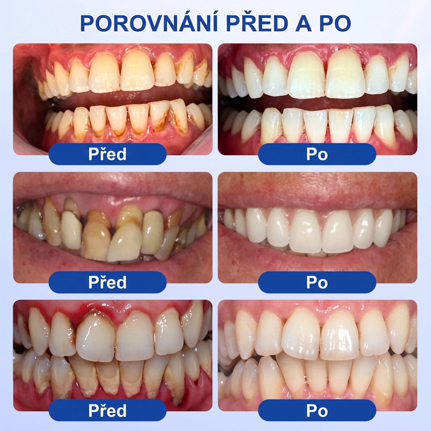 PureShade®👍🦷GumRevive regenerační gel na dásně – pro zdravější dásně a sebevědomější úsměv 👍