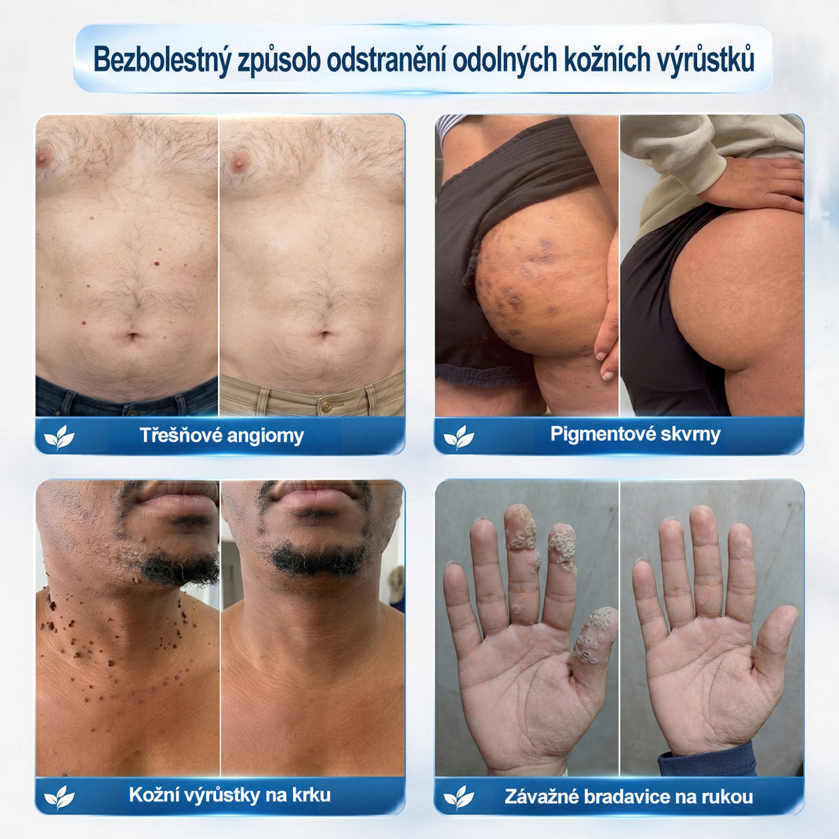 Hiskin®🎁 Zbývá už jen 5 balení!🔥 Nyní získáte další slevu 50 %!✨ Dopřejte si péči, kterou si zasloužíte, a udělejte něco pro svůj lepší pocit každý den.⏳ Nečekejte příliš dlouho — tato speciální nabídka nemusí být znovu dostupná.