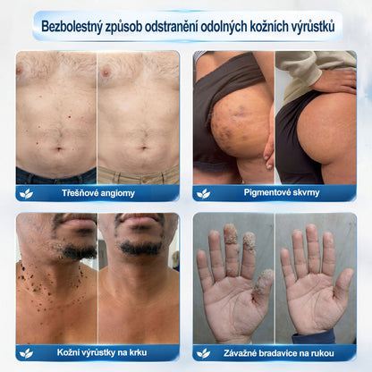 Hiskin®🎁 Zbývá už jen 5 balení!🔥 Nyní získáte další slevu 50 %!✨ Dopřejte si péči, kterou si zasloužíte, a udělejte něco pro svůj lepší pocit každý den.⏳ Nečekejte příliš dlouho — tato speciální nabídka nemusí být znovu dostupná.