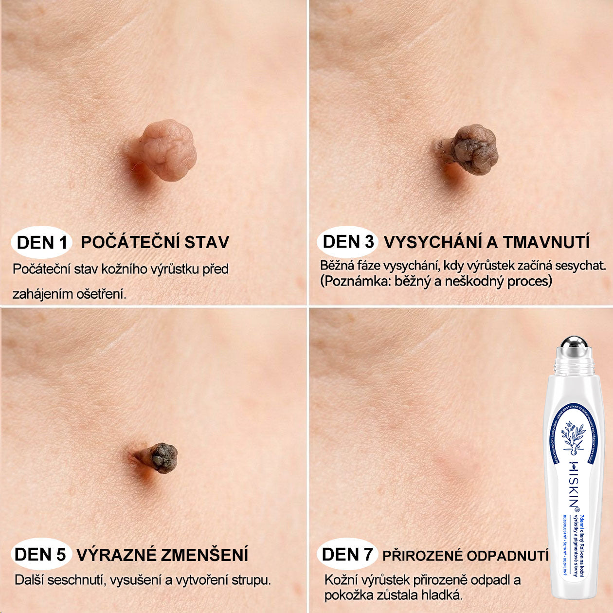 Hiskin®🎁 Zbývá už jen 5 balení!🔥 Nyní získáte další slevu 50 %!✨ Dopřejte si péči, kterou si zasloužíte, a udělejte něco pro svůj lepší pocit každý den.⏳ Nečekejte příliš dlouho — tato speciální nabídka nemusí být znovu dostupná.