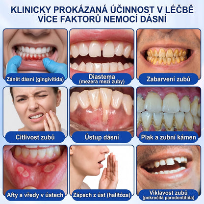 PureShade®👍🦷GumRevive regenerační gel na dásně – pro zdravější dásně a sebevědomější úsměv 👍