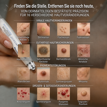 🇩🇪 𝐇𝐈𝐒𝐊𝐈𝐍®👩‍⚕️ 𝟕-𝐓𝐚𝐠𝐞-𝐇𝐚𝐮𝐭𝐚𝐧𝐡ä𝐧𝐠𝐬𝐞𝐥- & 𝐅𝐥𝐞𝐜𝐤𝐞𝐧𝐞𝐧𝐭𝐟𝐞𝐫𝐧𝐞𝐫 – 𝐅𝐨𝐫𝐭𝐬𝐜𝐡𝐫𝐢𝐭𝐭𝐥𝐢𝐜𝐡𝐞𝐫 𝐑𝐨𝐥𝐥-𝐨𝐧-𝐒𝐭𝐢𝐟𝐭 𝐳𝐮𝐫 𝐬𝐜𝐡𝐦𝐞𝐫𝐳𝐟𝐫𝐞𝐢𝐞𝐧 𝐮𝐧𝐝 𝐧𝐚𝐫𝐛𝐞𝐧𝐟𝐫𝐞𝐢𝐞𝐧 𝐄𝐧𝐭𝐟𝐞𝐫𝐧𝐮𝐧𝐠 𝐯𝐨𝐧 𝐇𝐚𝐮𝐭𝐮𝐧𝐫𝐞𝐢𝐧𝐡𝐞𝐢𝐭𝐞𝐧