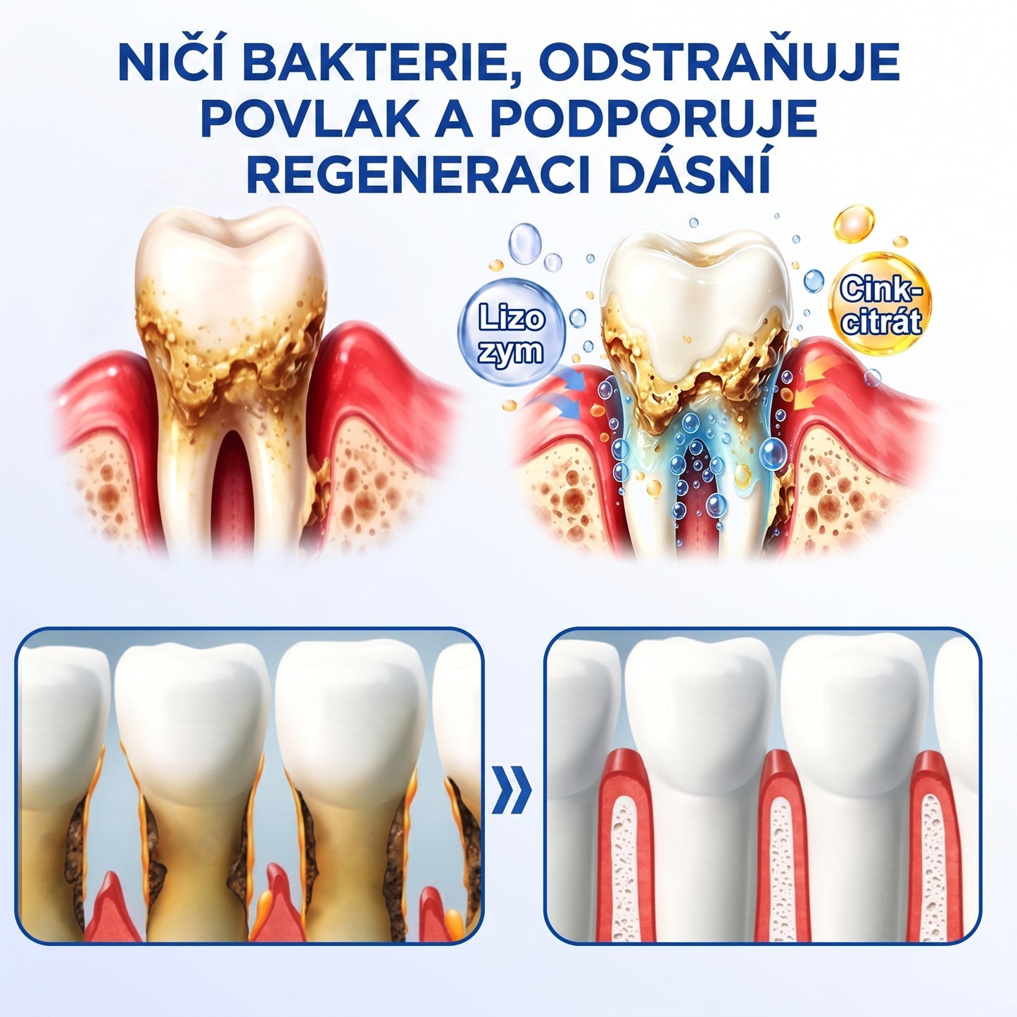 PureShade®👍🦷GumRevive regenerační gel na dásně – pro zdravější dásně a sebevědomější úsměv 👍